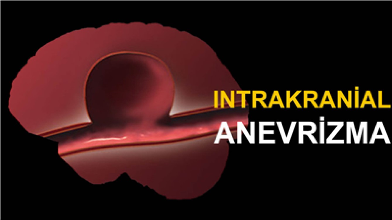 İNTRAKRANİAL ANEVRİZMA NEDİR?