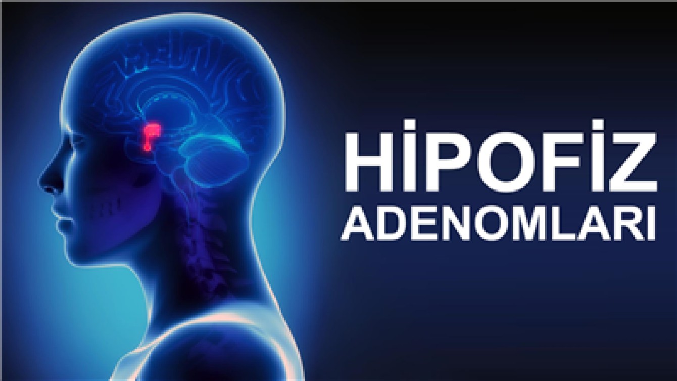 HİPOFİZ ADENOMLARI TEDAVİ EDİLMELİ Mİ?