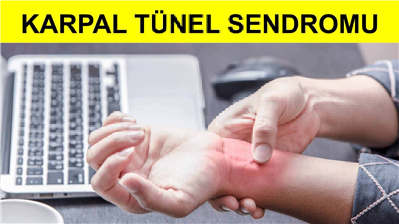 KARPAL TÜNEL SENDROMU