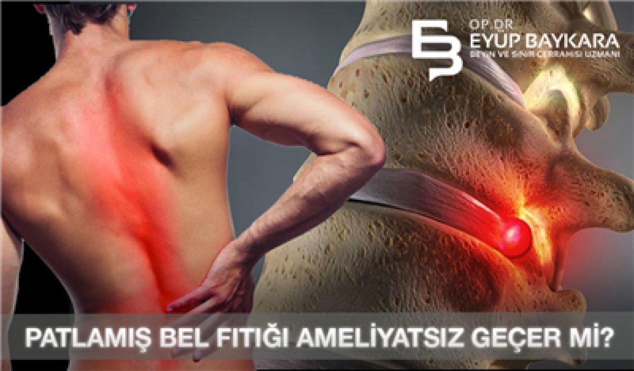 PATLAMIŞ BEL FITIĞI AMELİYATSIZ GEÇER Mİ