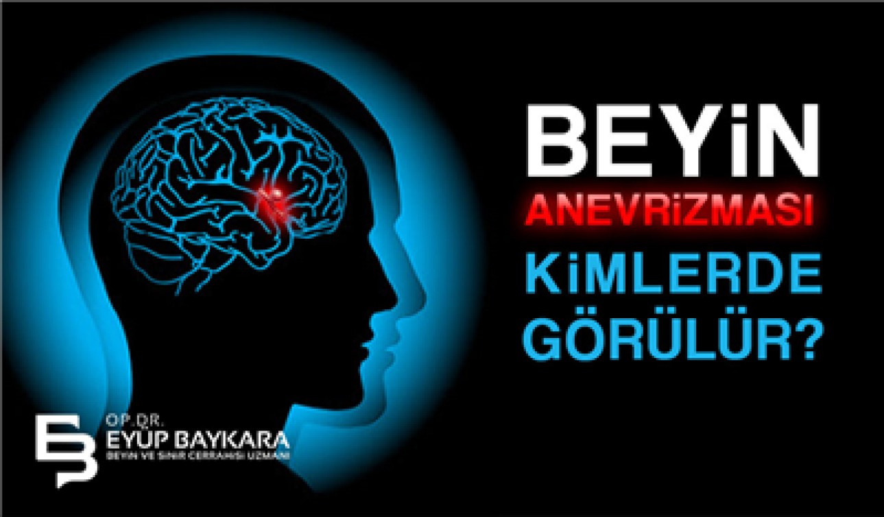 BEYİN ANEVRİZMASI KİMLERDE GÖRÜLÜR ?