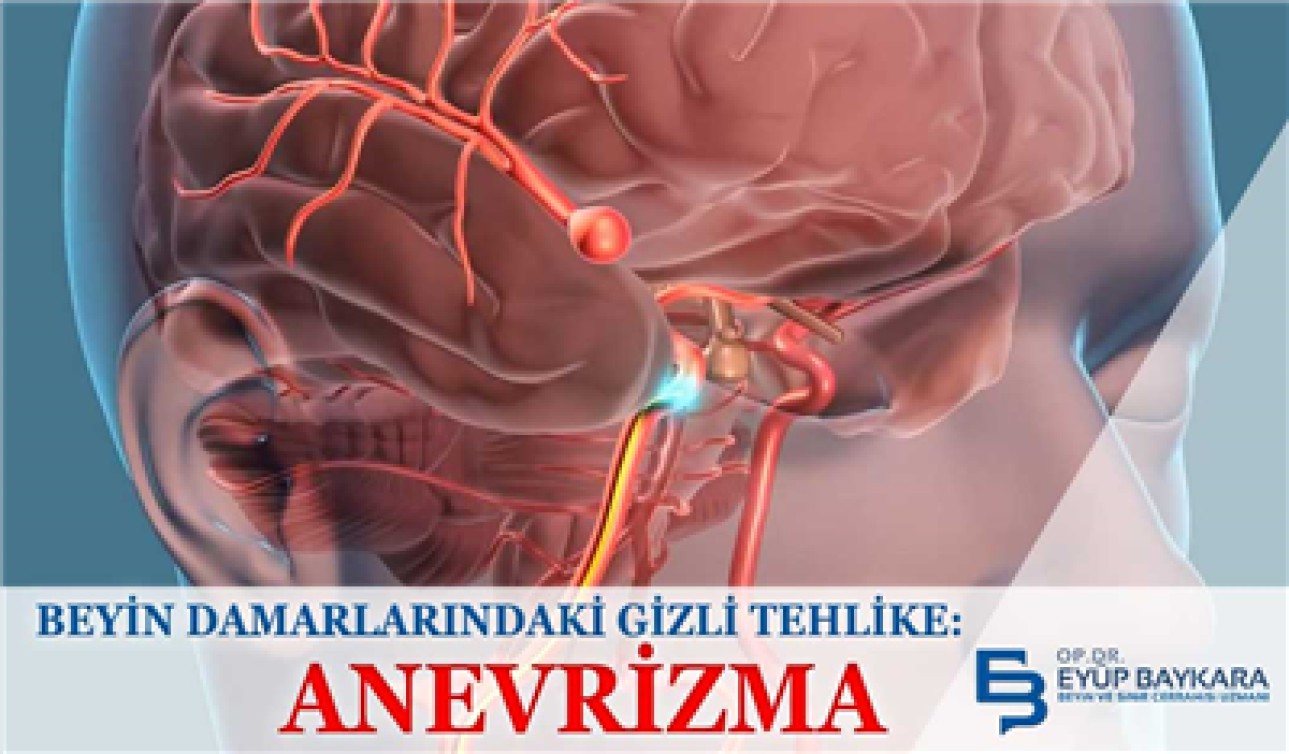BEYİN DAMARLARINDAKİ GİZLİ TEHLİKE (ANEVRİZMA)