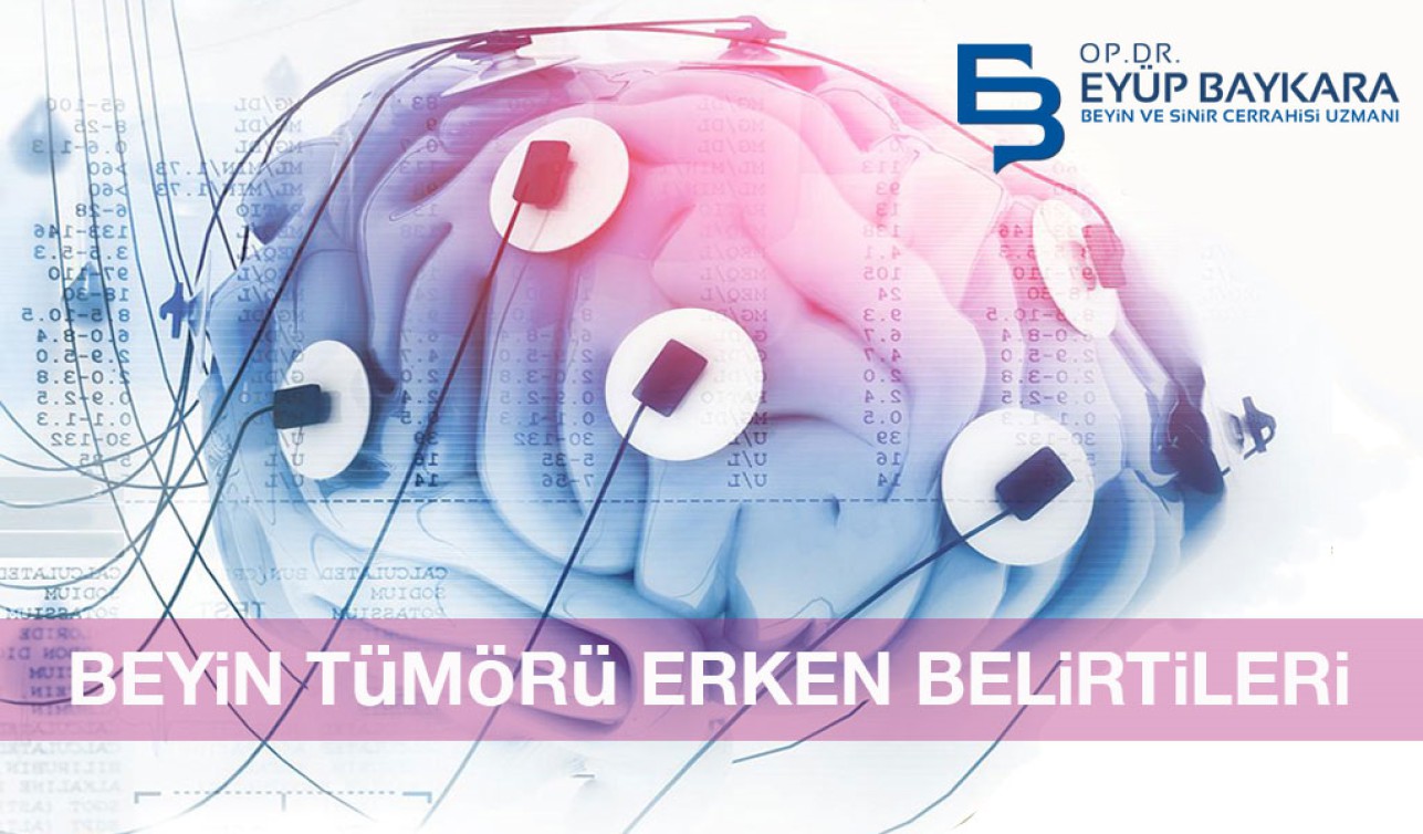 BEYİN TÜMÖRÜ ERKEN BELİRTİLERİ
