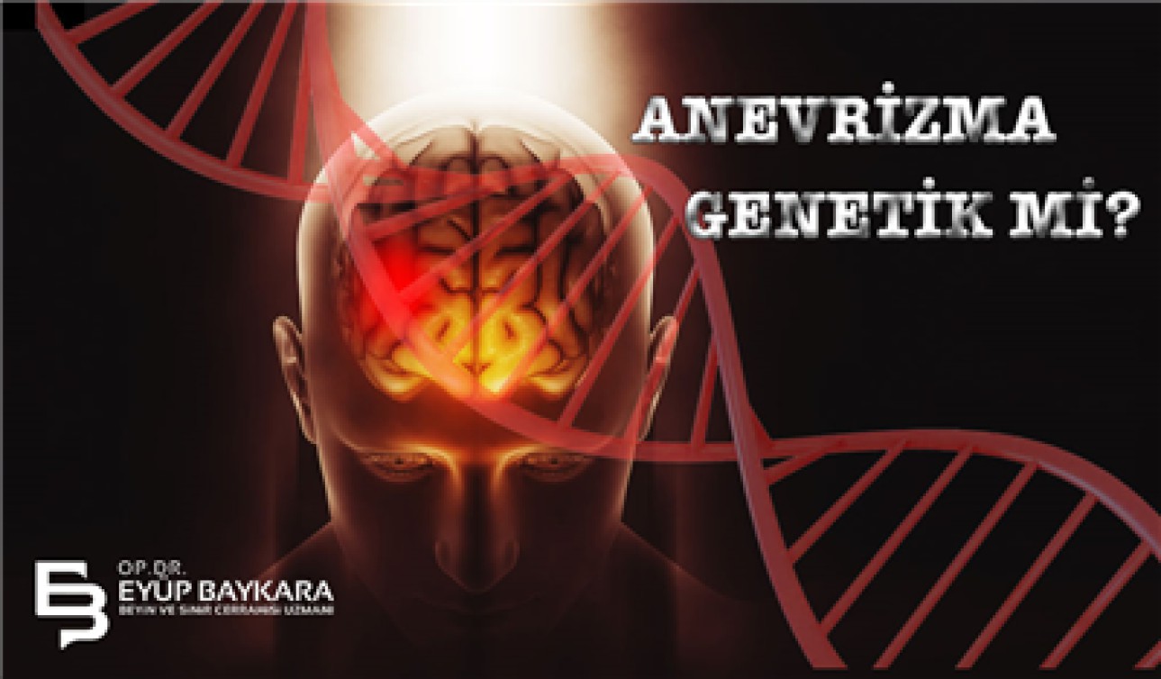 ANEVRİZMA GENETİK Mİ?