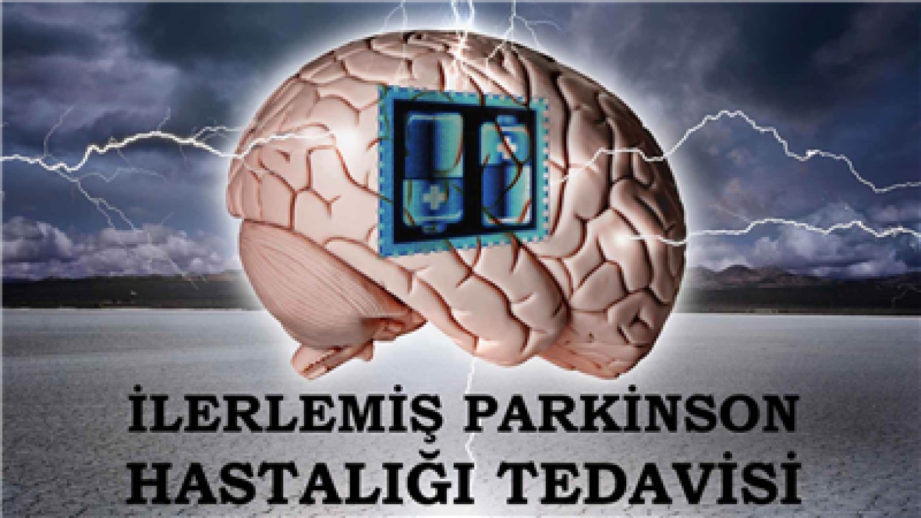 İLERLEMİŞ PARKİNSON HASTALIĞI