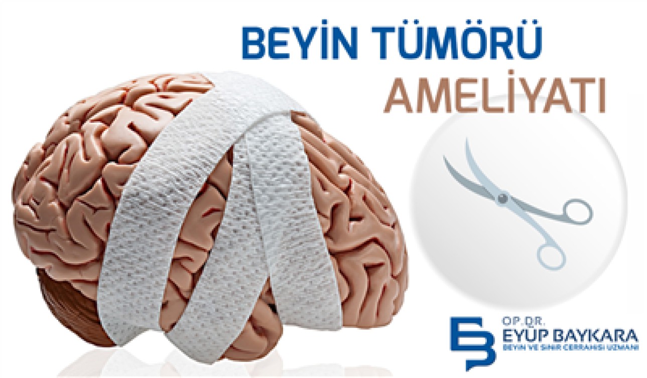 BEYİN TÜMÖRÜ AMELİYATI BAŞARI ORANI