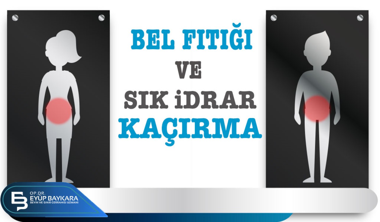 BEL FITIĞI VE SIK İDRAR KAÇIRMA