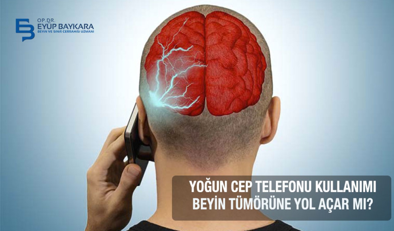 BEYİN TÜMÖRÜ VE CEP TELEFONU