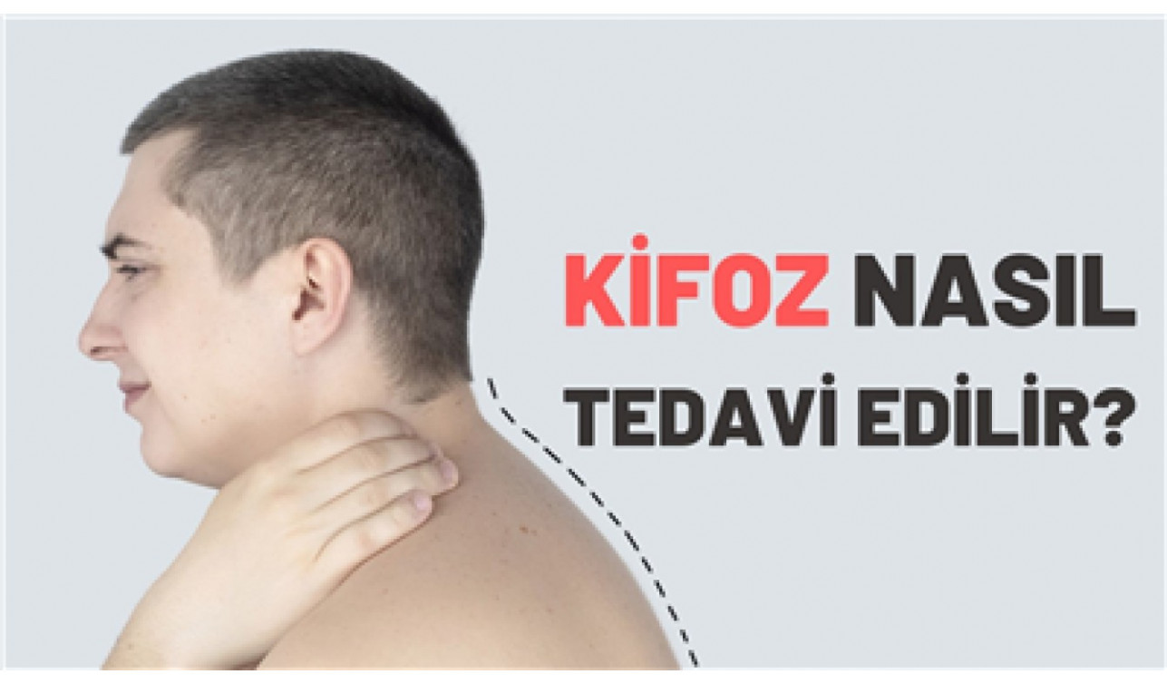 KİFOZ TEDAVİSİ NASIL YAPILIR?
