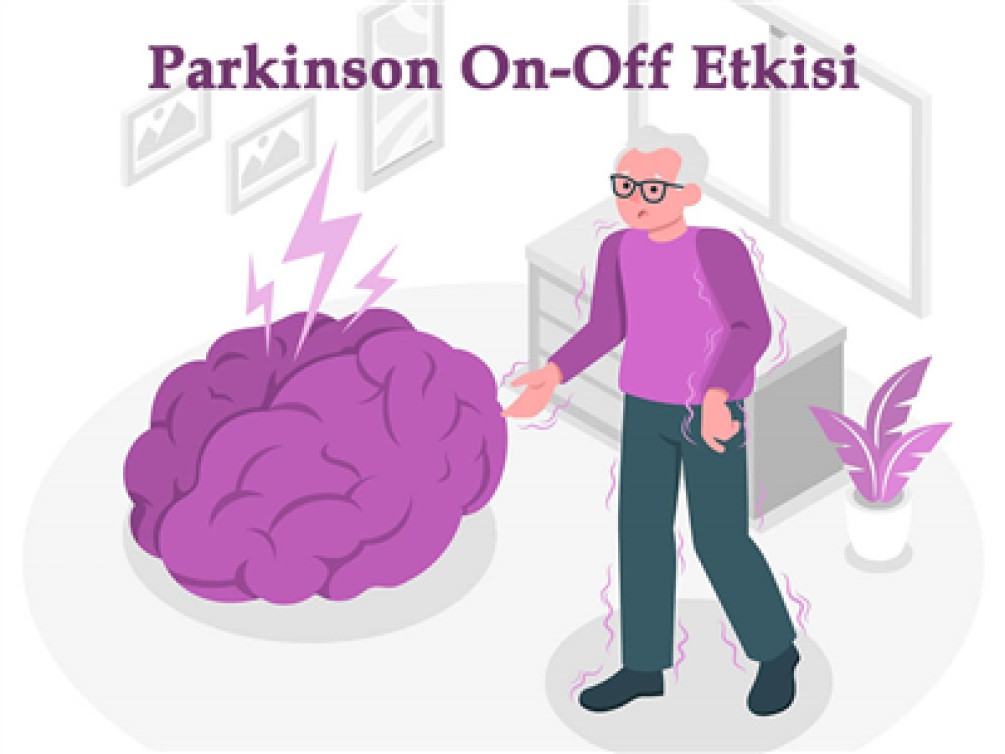 PARKİNSON ON-OFF ETKİSİ