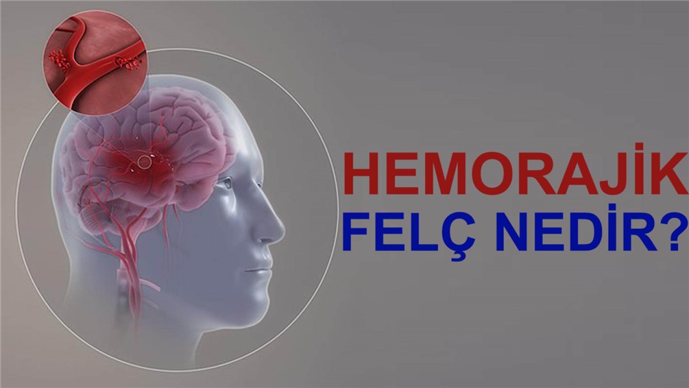 HEMORAJİK FELÇ NEDİR?