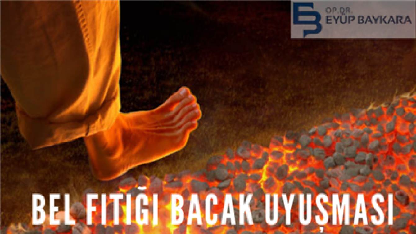BEL FITIĞI BACAK UYUŞMASI