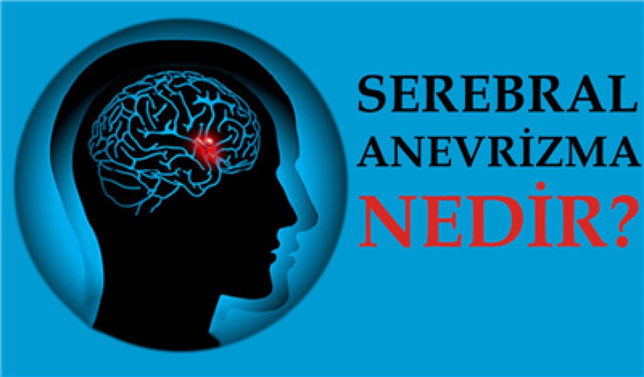 SEREBRAL ANEVRİZMA NEDİR?