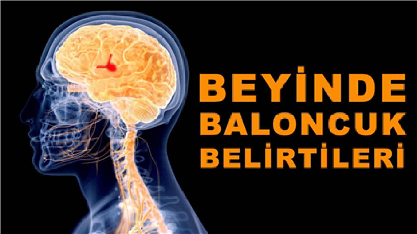 BEYİNDE BALONCUK BELİRTİLERİ