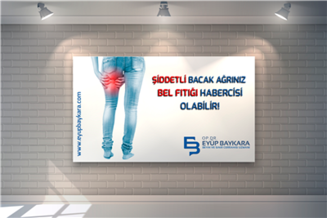 BEL FITIĞI BACAK AĞRISI